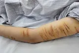 Trẻ vị thành niên và hành vi tự gây thương tích: Đừng để mạng xã hội thay thế kết nối gia đình