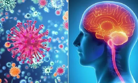 Bệnh não mô cầu nhóm B - mối đe dọa sức khỏe cộng đồng