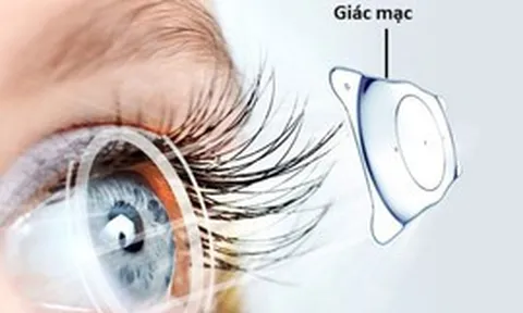 Tìm giải pháp giúp hơn 500.000 người chờ ghép giác mạc