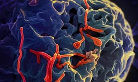 Bộ Y tế thông tin diễn biến phức tạp của dịch bệnh do virus Ebola