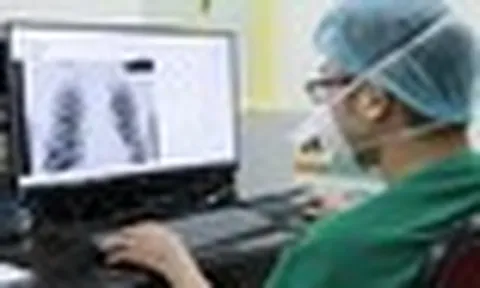 AI đọc phim X-quang, giám định bảo hiểm y tế: Bác sĩ có bị thay thế?