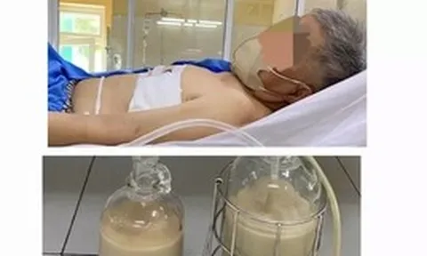 Hút ra hàng lít mủ từ phổi người đàn ông ở Đà Nẵng