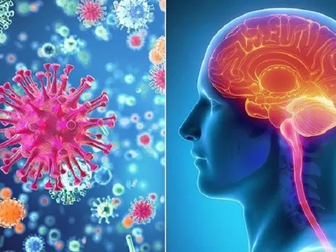 Bệnh não mô cầu nhóm B - mối đe dọa sức khỏe cộng đồng