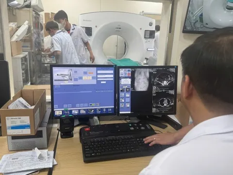 Chụp X-quang dưới 6 phút, BHYT không thanh toán: Đề nghị điều chỉnh để bảo đảm quyền lợi người bệnh