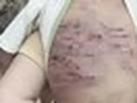 TP.HCM: Bé 2 tuổi nghi bị bạo hành, thương tích rất nặng khắp cơ thể