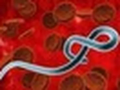 Chưa có vaccine chủng Ebola mới, Bộ Y tế khẩn cấp lên phương án ứng phó