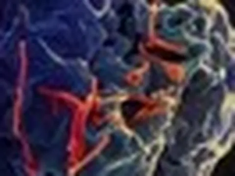 Dịch Ebola diễn biến phức tạp, Bộ Y tế họp khẩn
