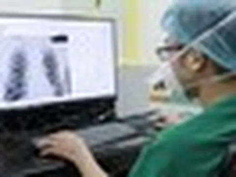 AI đọc phim X-quang, giám định bảo hiểm y tế: Bác sĩ có bị thay thế?
