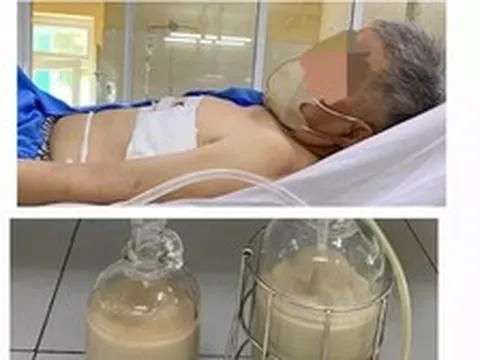 Hút ra hàng lít mủ từ phổi người đàn ông ở Đà Nẵng