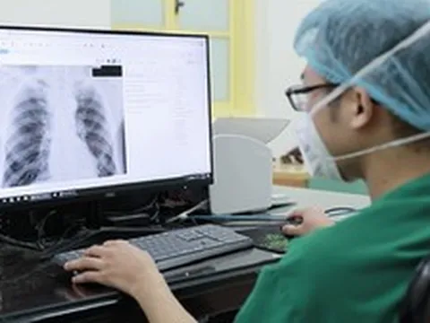 AI đọc phim X-quang, giám định bảo hiểm y tế: Bác sĩ có bị thay thế?